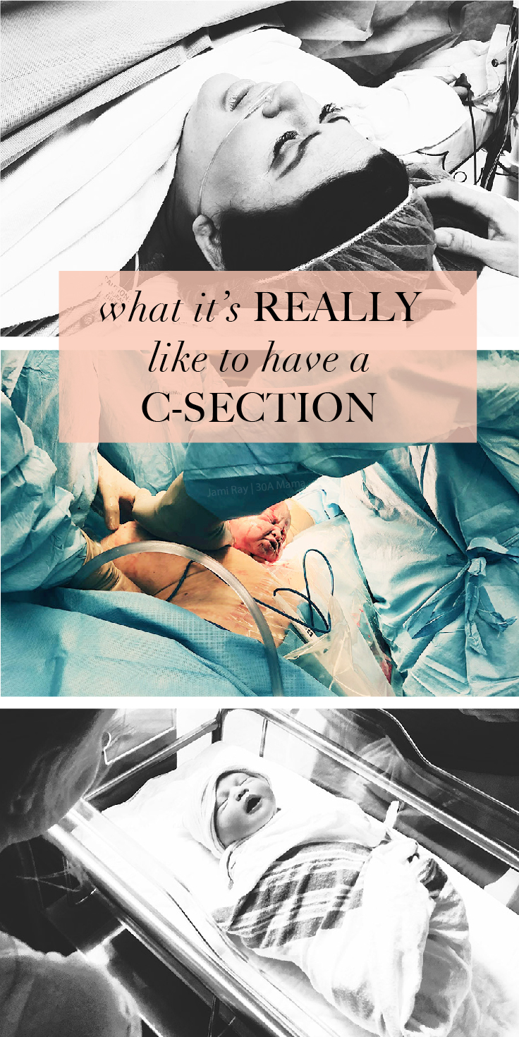 What It's Really Like to Have a C-Section //  30A Mama