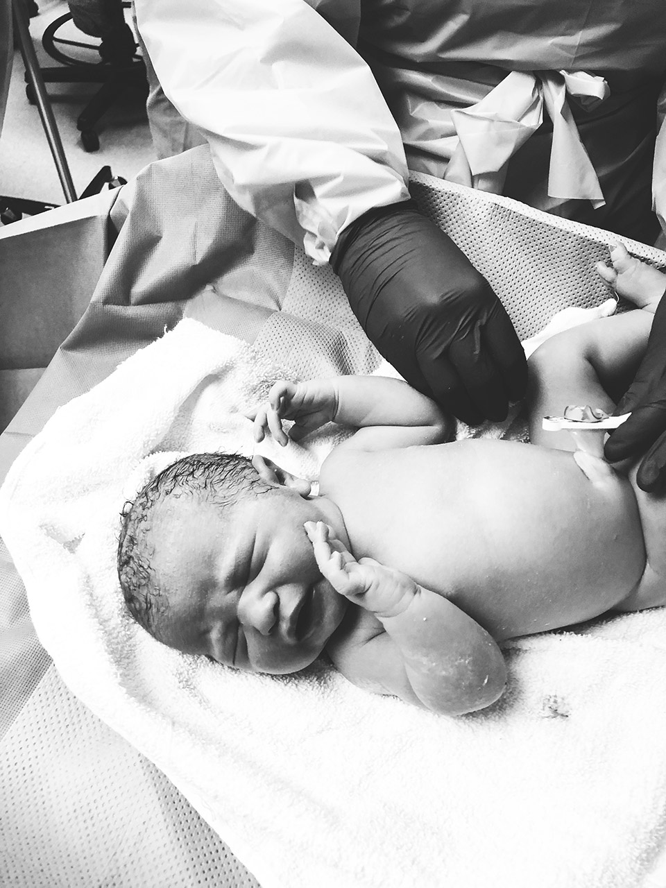 What It's Really Like to Have a C Section - 30A Mama